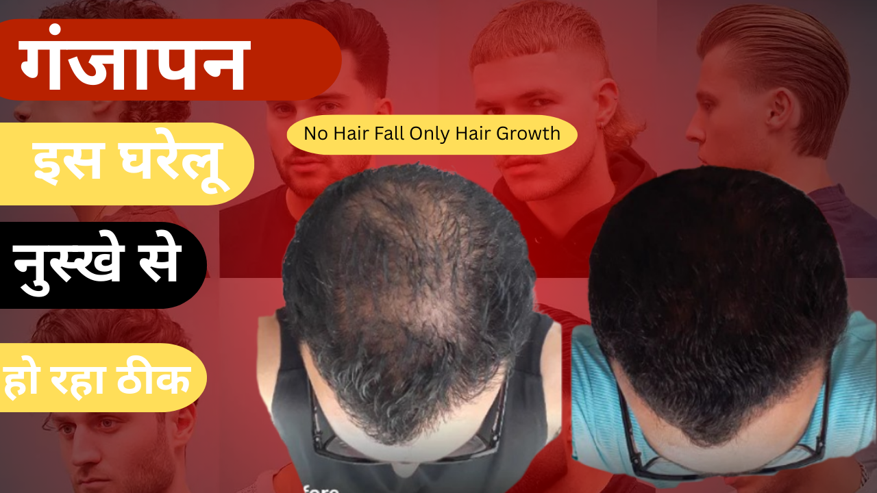 बाल झड़ना, बाल कमजोर होना और हेयर लाइन पीछे जाना – इस आयुर्वेदिक प्रयोग से मिलेगा संपूर्ण लाभ